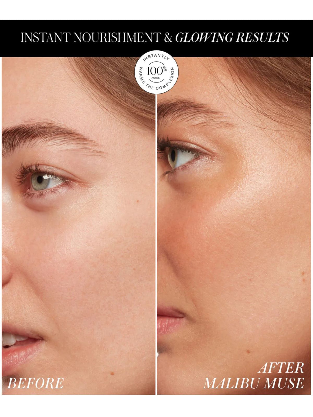 ReDimension Hydra Bronzer