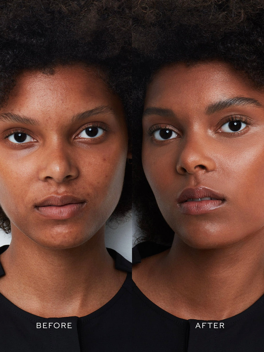 Vital Skincare Complexion Drops