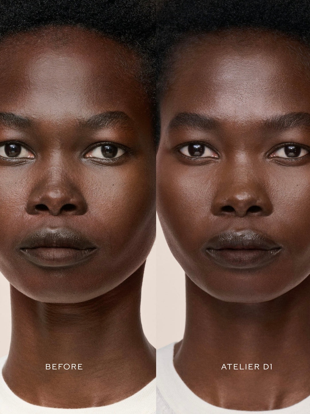 Vital Skincare Concealer