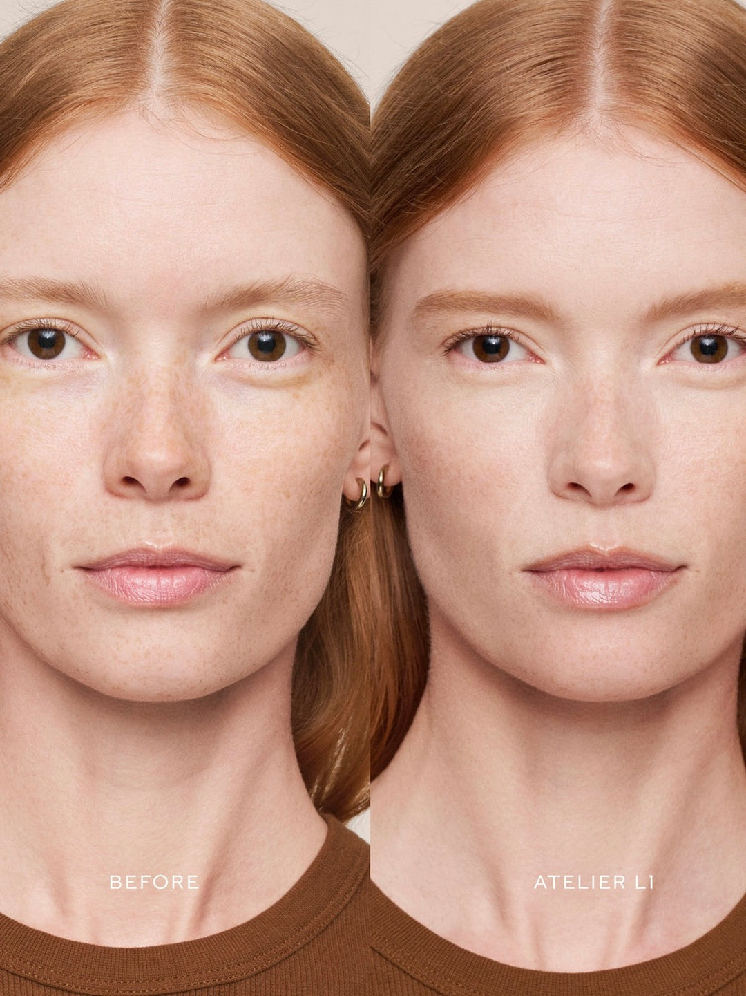 Vital Skincare Concealer