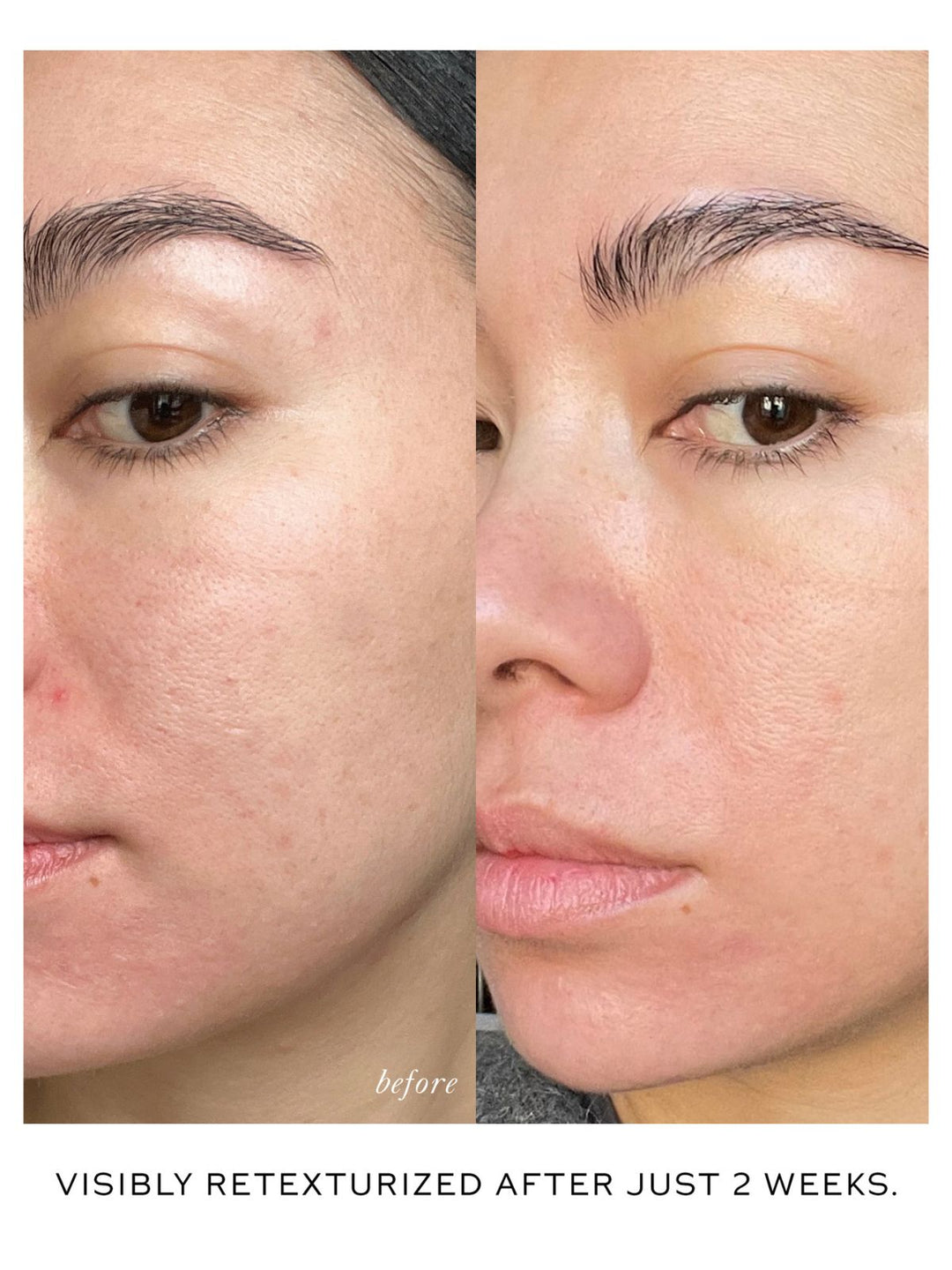 Westman Atelier Skin Activator Serum Before/After