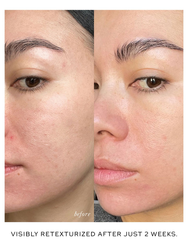 Westman Atelier Skin Activator Serum Before/After