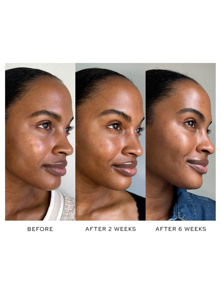 Suprême C Serum
