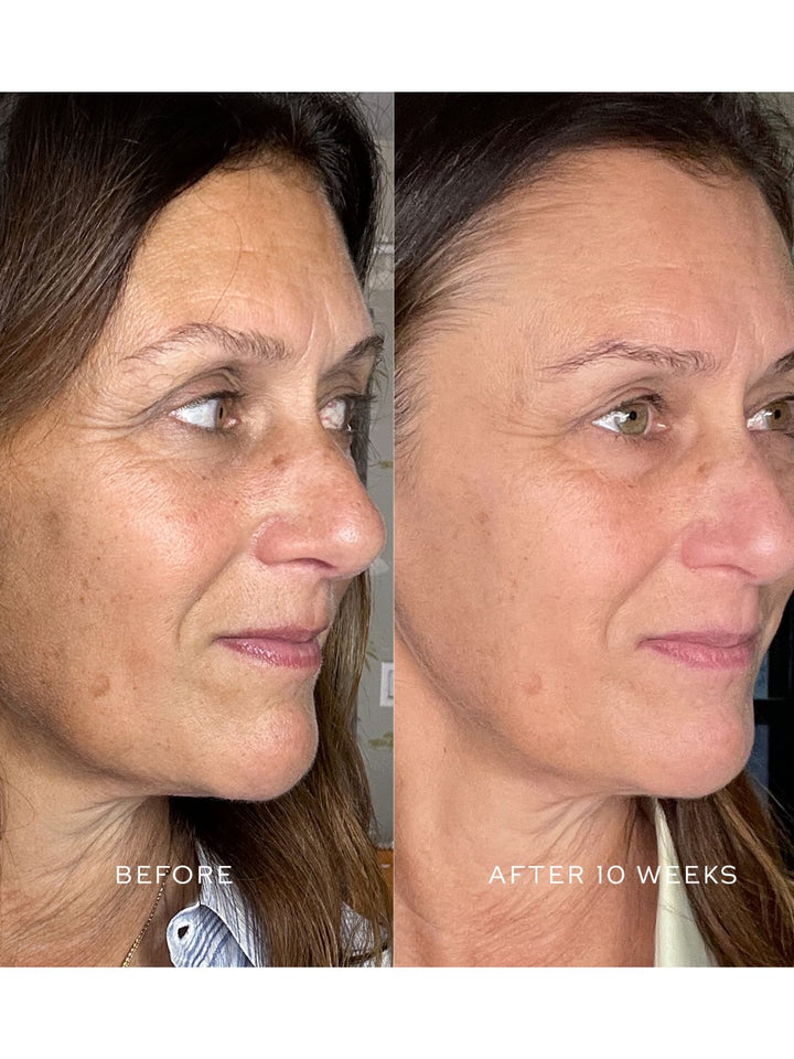 Suprême C Serum